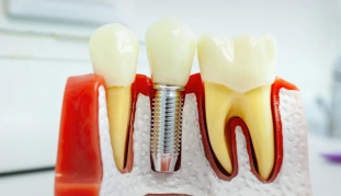 Restorative Dental Solutions